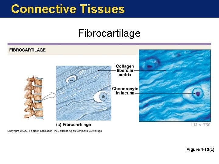 Connective Tissues Fibrocartilage Figure 4 -10(c) 
