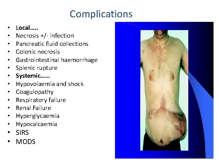 Complications • • • • Local…. . Necrosis +/- infection Pancreatic fluid collections Colonic