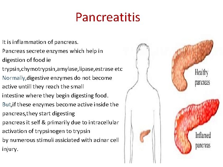 Pancreatitis It is inflammation of pancreas. Pancreas secrete enzymes which help in digestion of
