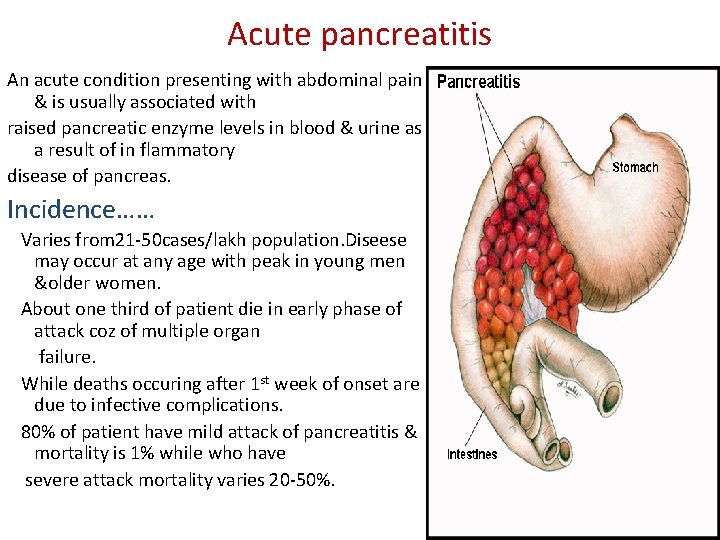 Acute pancreatitis An acute condition presenting with abdominal pain & is usually associated with