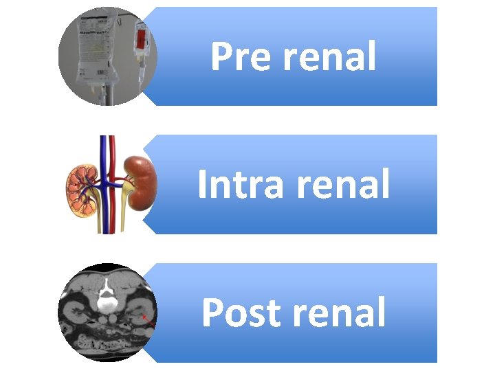 Pre renal Intra renal Post renal 