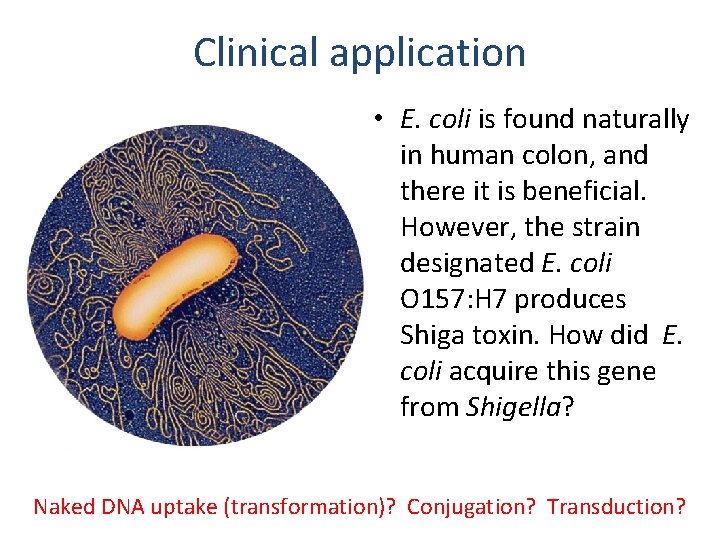 Clinical application • E. coli is found naturally in human colon, and there it