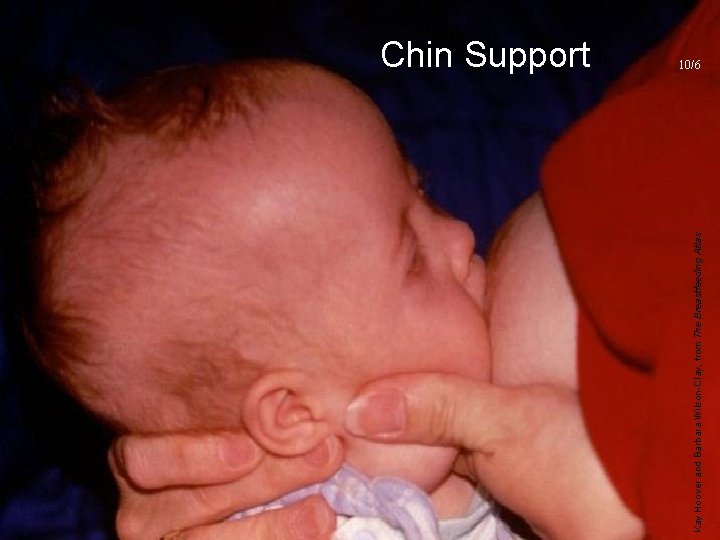 Chin Support 2006 Kay Hoover and Barbara Wilson-Clay, from The Breastfeeding Atlas UNICEF/WHO Breastfeeding