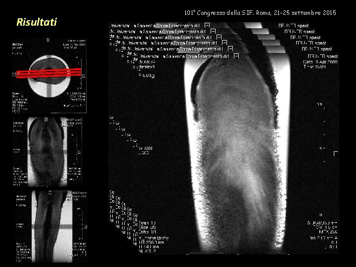 Risultati 101° Congresso della SIF. Roma, 21 -25 settembre 2015 