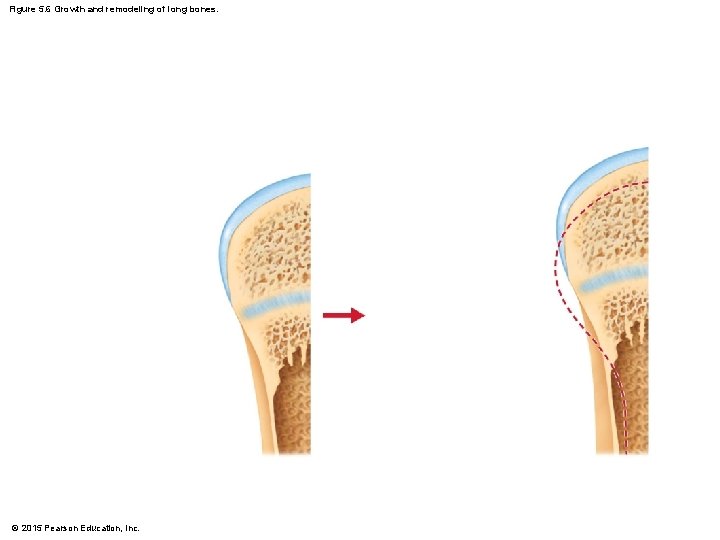 Figure 5. 6 Growth and remodeling of long bones. © 2015 Pearson Education, Inc.
