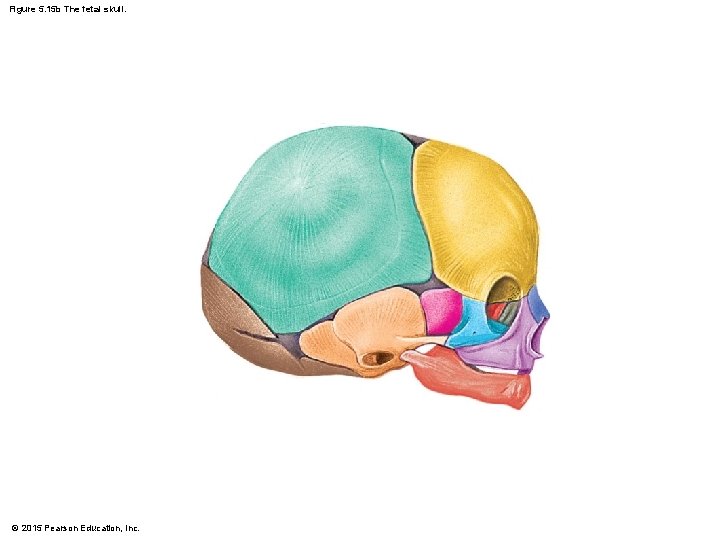Figure 5. 15 b The fetal skull. © 2015 Pearson Education, Inc. 