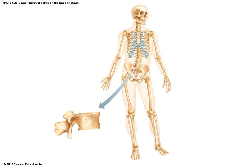 Figure 5. 2 b Classification of bones on the basis of shape. © 2015