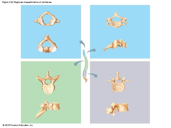 Figure 5. 20 Regional characteristics of vertebrae. © 2015 Pearson Education, Inc. 
