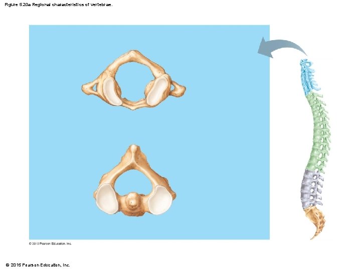 Figure 5. 20 a Regional characteristics of vertebrae. © 2015 Pearson Education, Inc. 