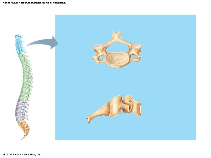 Figure 5. 20 b Regional characteristics of vertebrae. © 2015 Pearson Education, Inc. 