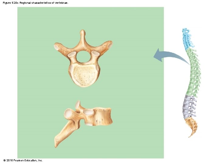Figure 5. 20 c Regional characteristics of vertebrae. © 2015 Pearson Education, Inc. 