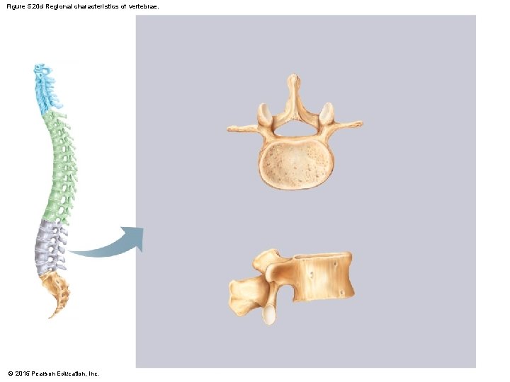 Figure 5. 20 d Regional characteristics of vertebrae. © 2015 Pearson Education, Inc. 