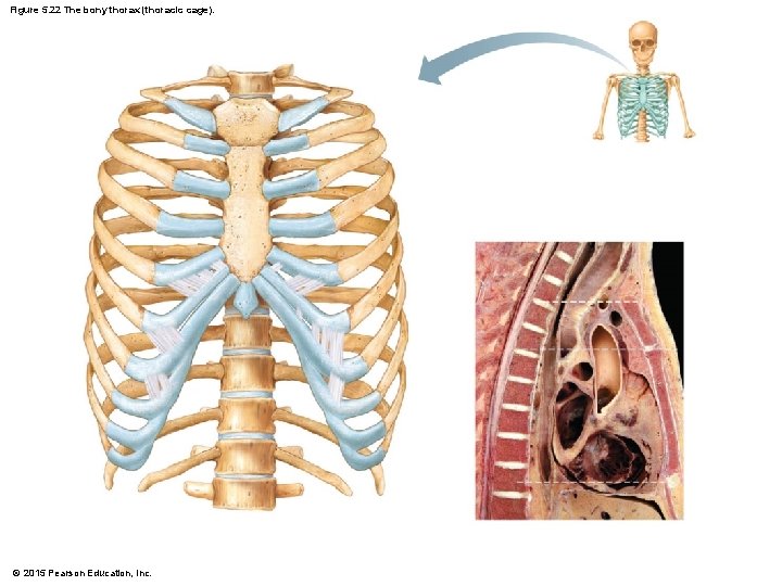 Figure 5. 22 The bony thorax (thoracic cage). © 2015 Pearson Education, Inc. 