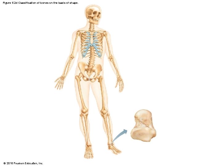 Figure 5. 2 d Classification of bones on the basis of shape. © 2015