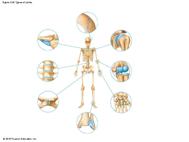 Figure 5. 30 Types of joints. © 2015 Pearson Education, Inc. 