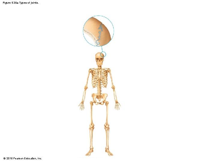 Figure 5. 30 a Types of joints. © 2015 Pearson Education, Inc. 