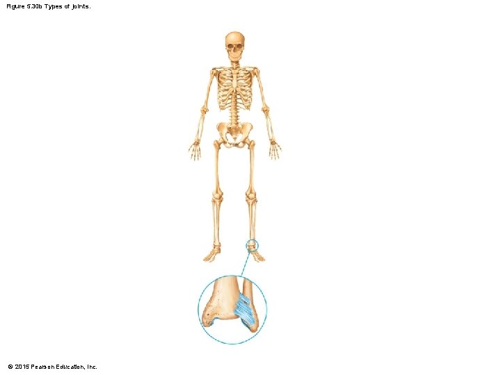 Figure 5. 30 b Types of joints. © 2015 Pearson Education, Inc. 