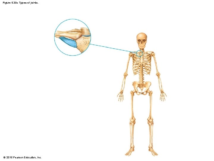Figure 5. 30 c Types of joints. © 2015 Pearson Education, Inc. 