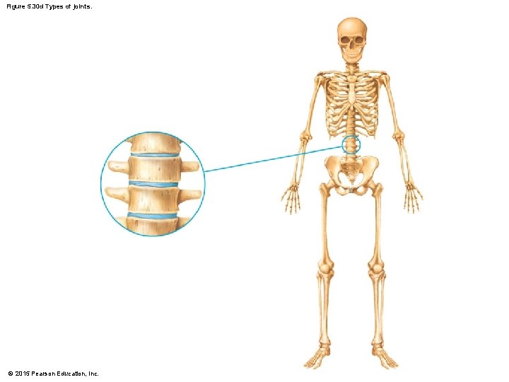 Figure 5. 30 d Types of joints. © 2015 Pearson Education, Inc. 