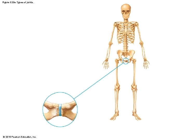 Figure 5. 30 e Types of joints. © 2015 Pearson Education, Inc. 