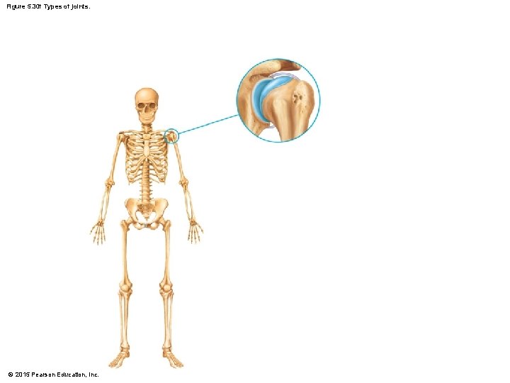 Figure 5. 30 f Types of joints. © 2015 Pearson Education, Inc. 