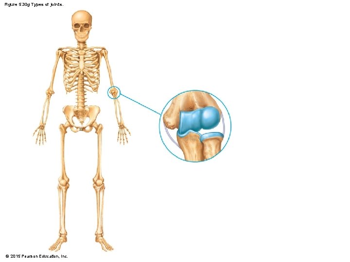 Figure 5. 30 g Types of joints. © 2015 Pearson Education, Inc. 
