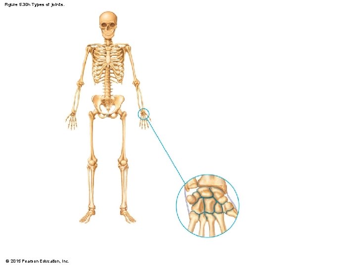 Figure 5. 30 h Types of joints. © 2015 Pearson Education, Inc. 