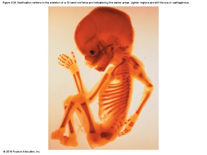 Figure 5. 34 Ossification centers in the skeleton of a 12 -week-old fetus are