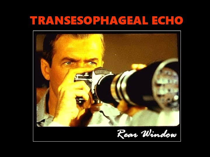 TRANSESOPHAGEAL ECHO 