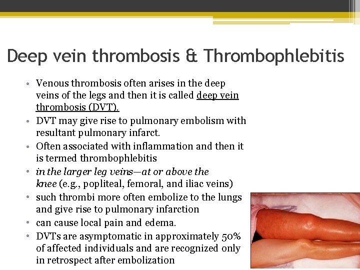 Deep vein thrombosis & Thrombophlebitis • Venous thrombosis often arises in the deep veins