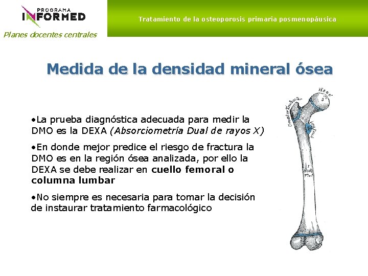 Tratamiento de la osteoporosis primaria posmenopáusica Planes docentes centrales Medida de la densidad mineral