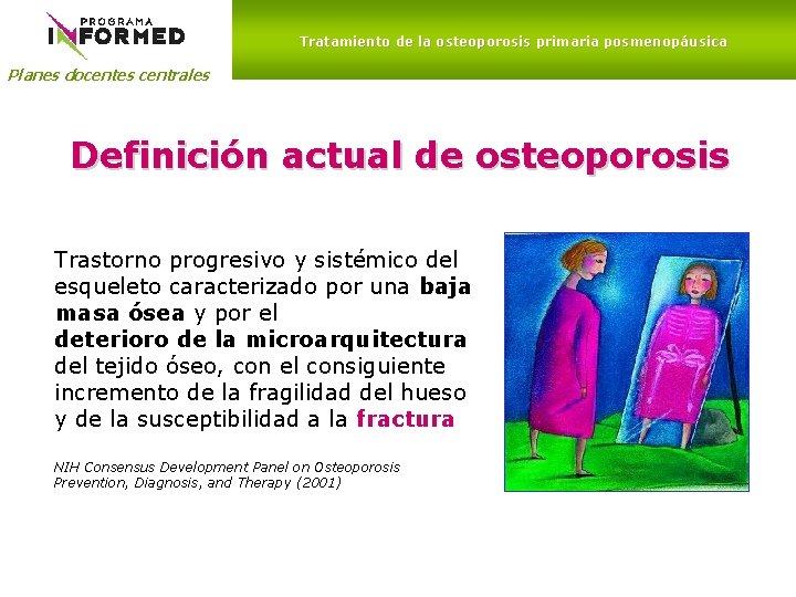 Tratamiento de la osteoporosis primaria posmenopáusica Planes docentes centrales Definición actual de osteoporosis Trastorno