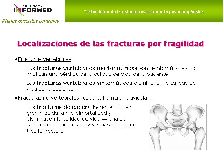 Tratamiento de la osteoporosis primaria posmenopáusica Planes docentes centrales Localizaciones de las fracturas por