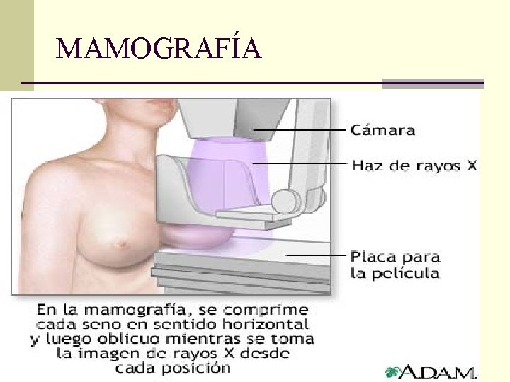 MAMOGRAFÍA 