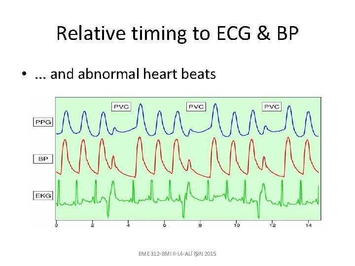 Relative timing to ECG & BP • . . . and abnormal heart beats