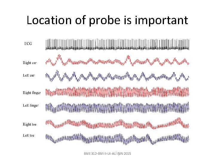 Location of probe is important BME 312 -BMI II-L 4 -ALİ IŞIN 2015 