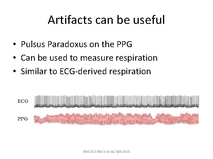 Artifacts can be useful • Pulsus Paradoxus on the PPG • Can be used