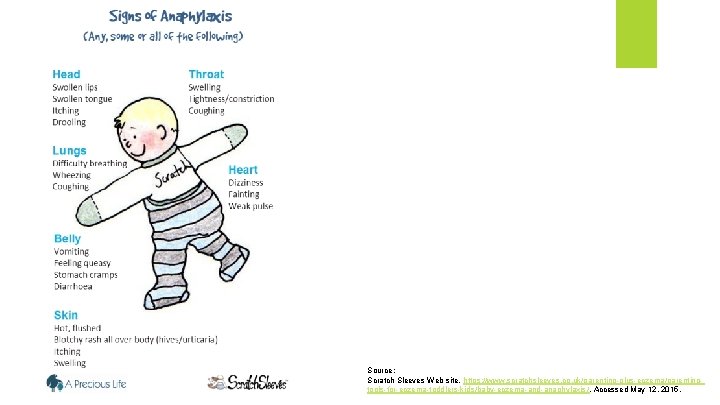 Source: Scratch Sleeves Web site. https: //www. scratchsleeves. co. uk/parenting-plus-eczema/parentingtools-for-eczema-toddlers-kids/baby-eczema-and-anaphylaxis /. Accessed May 12,