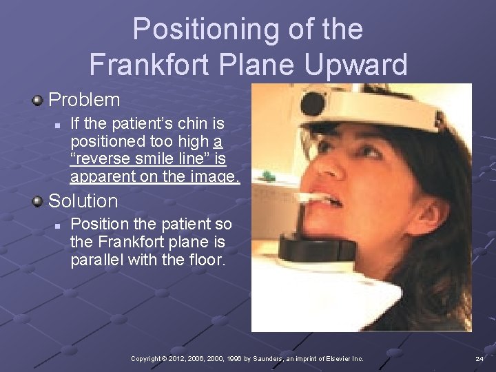 Positioning of the Frankfort Plane Upward Problem n If the patient’s chin is positioned