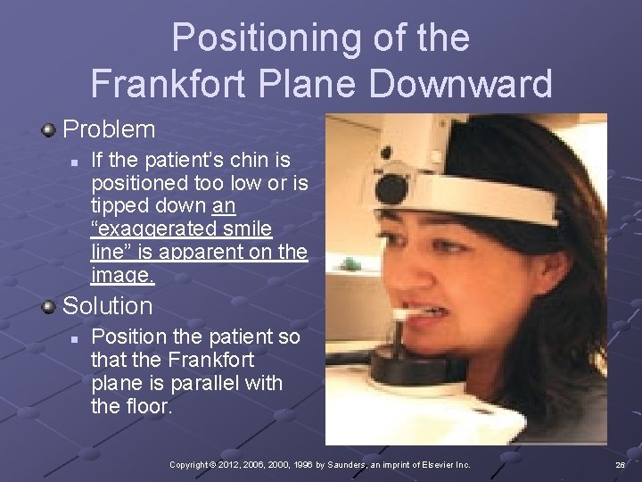 Positioning of the Frankfort Plane Downward Problem n If the patient’s chin is positioned