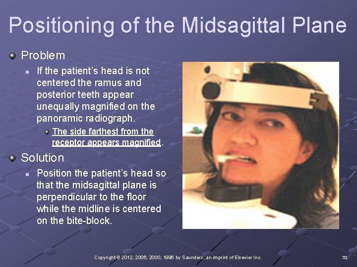 Positioning of the Midsagittal Plane Problem n If the patient’s head is not centered