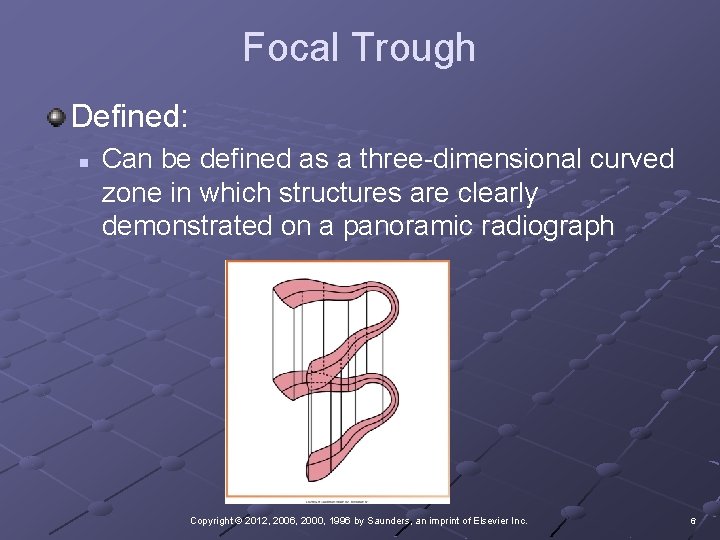 Focal Trough Defined: n Can be defined as a three-dimensional curved zone in which