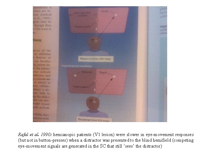 Rafal et al. 1990: hemianopic patients (V 1 lesion) were slower in eye-movement responses