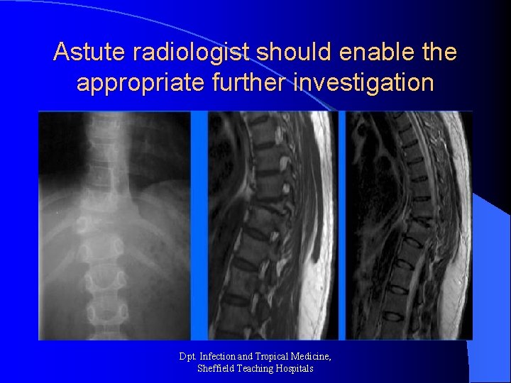 Astute radiologist should enable the appropriate further investigation Dpt. Infection and Tropical Medicine, Sheffield