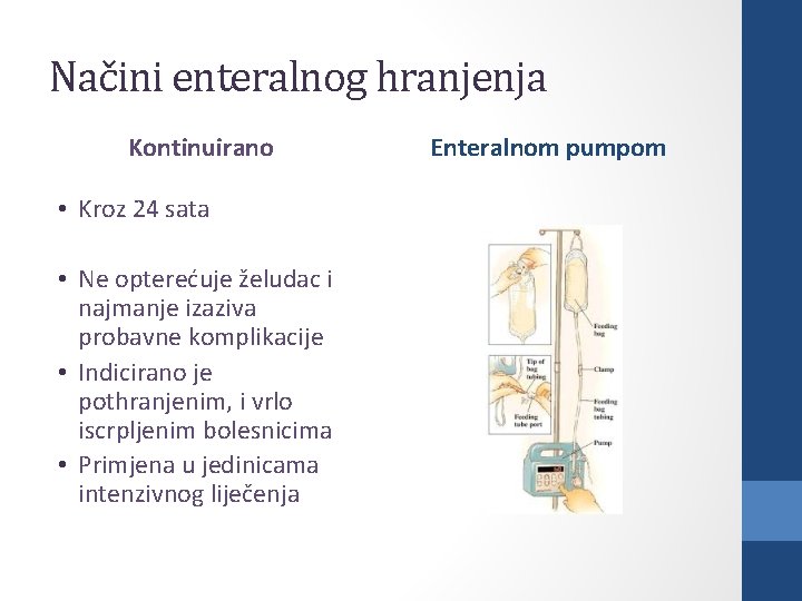 Načini enteralnog hranjenja Kontinuirano • Kroz 24 sata • Ne opterećuje želudac i najmanje