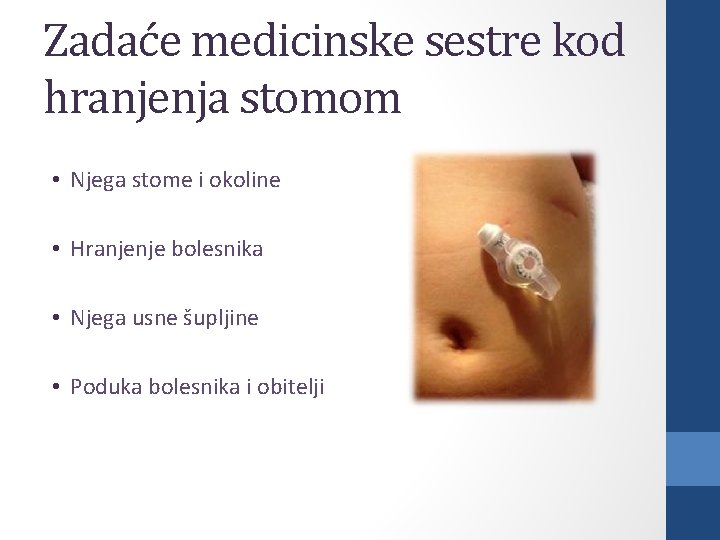 Zadaće medicinske sestre kod hranjenja stomom • Njega stome i okoline • Hranjenje bolesnika