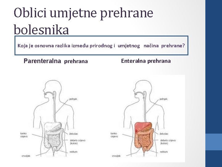 Oblici umjetne prehrane bolesnika Koja je osnovna razlika između prirodnog i umjetnog načina prehrane?