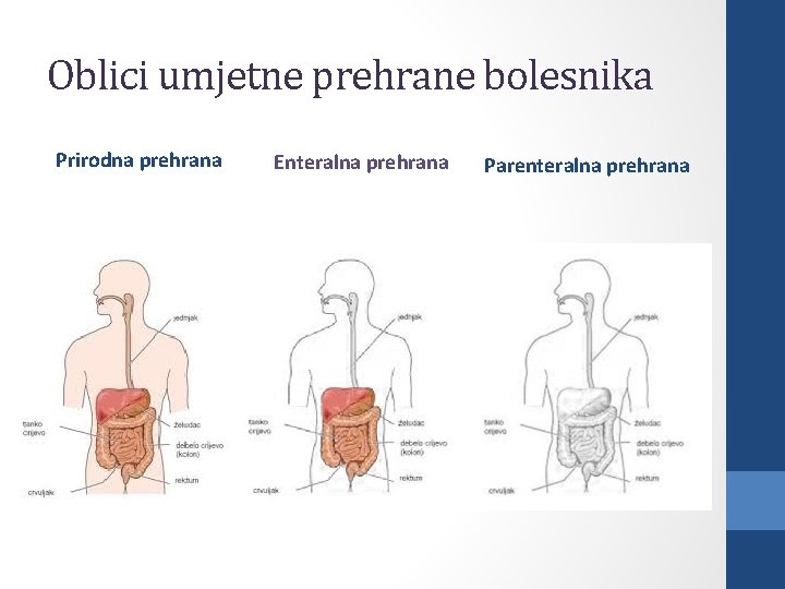 Oblici umjetne prehrane bolesnika Prirodna prehrana Enteralna prehrana Parenteralna prehrana 