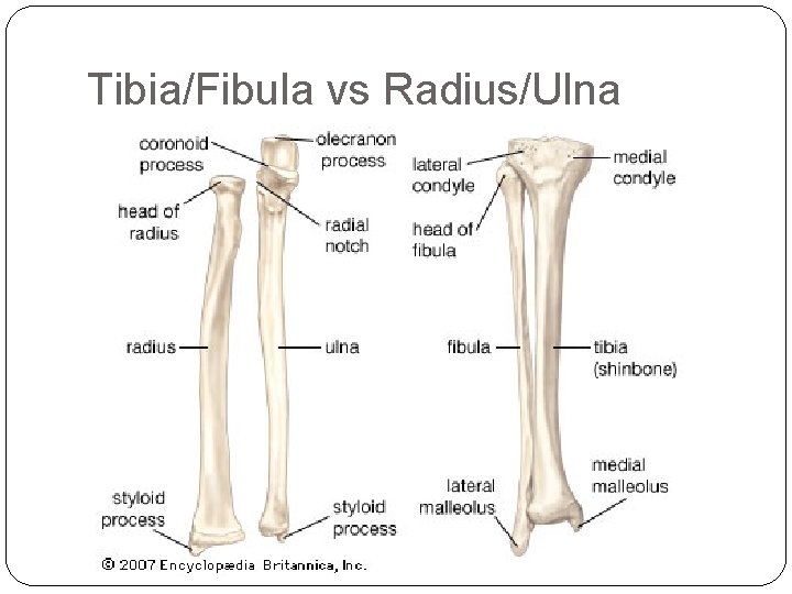 Tibia/Fibula vs Radius/Ulna 