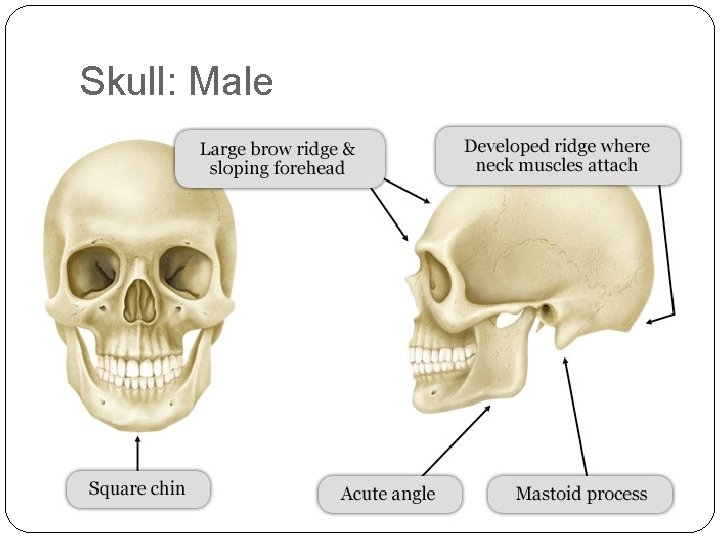 Skull: Male 